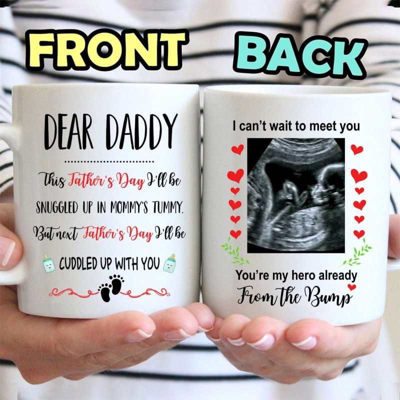 Personalized Ultrasound Image Snuggled Up Mug Father’S Day Gift For Father To Be From The Bump