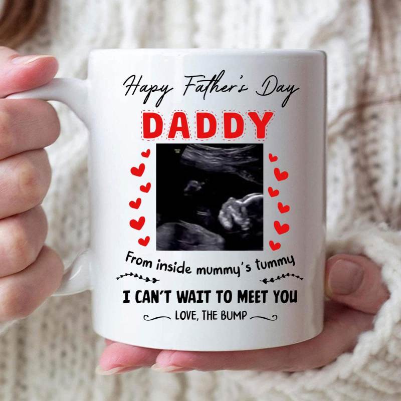 Personalized Happy Father’S Day Daddy Bump Ultrasound Mug For Dad To Be