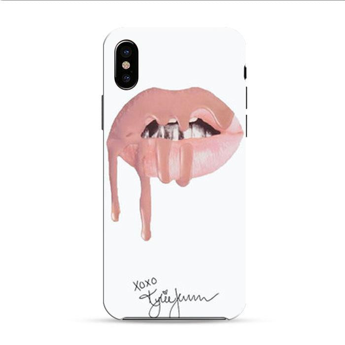 Kylie Jenner Candy K Lips iPhone XR 3D Case