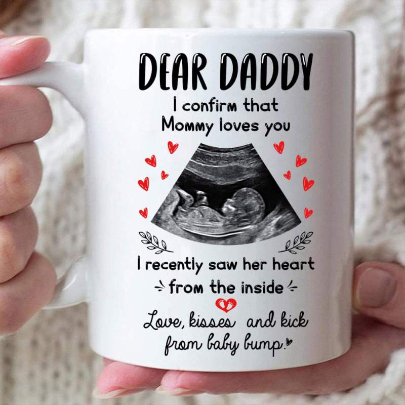 Personalized Ultrasound Gift For Dad To Be Mommy Loves You Mug