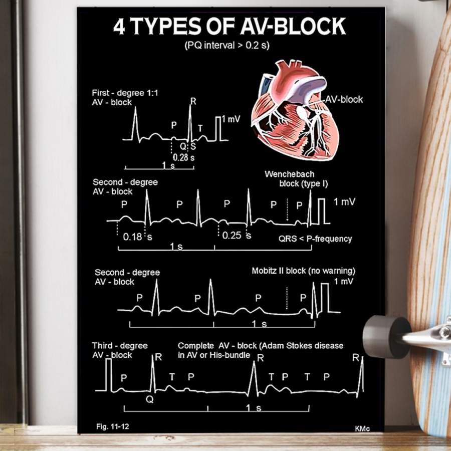 ECG Heart Four Types Of AV-Block Cardiologist Special Unique Poster