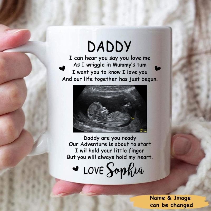 Personalized Sonogram Ultrasound Custom Coffee Mugs Gifts Idea Daddy To Be