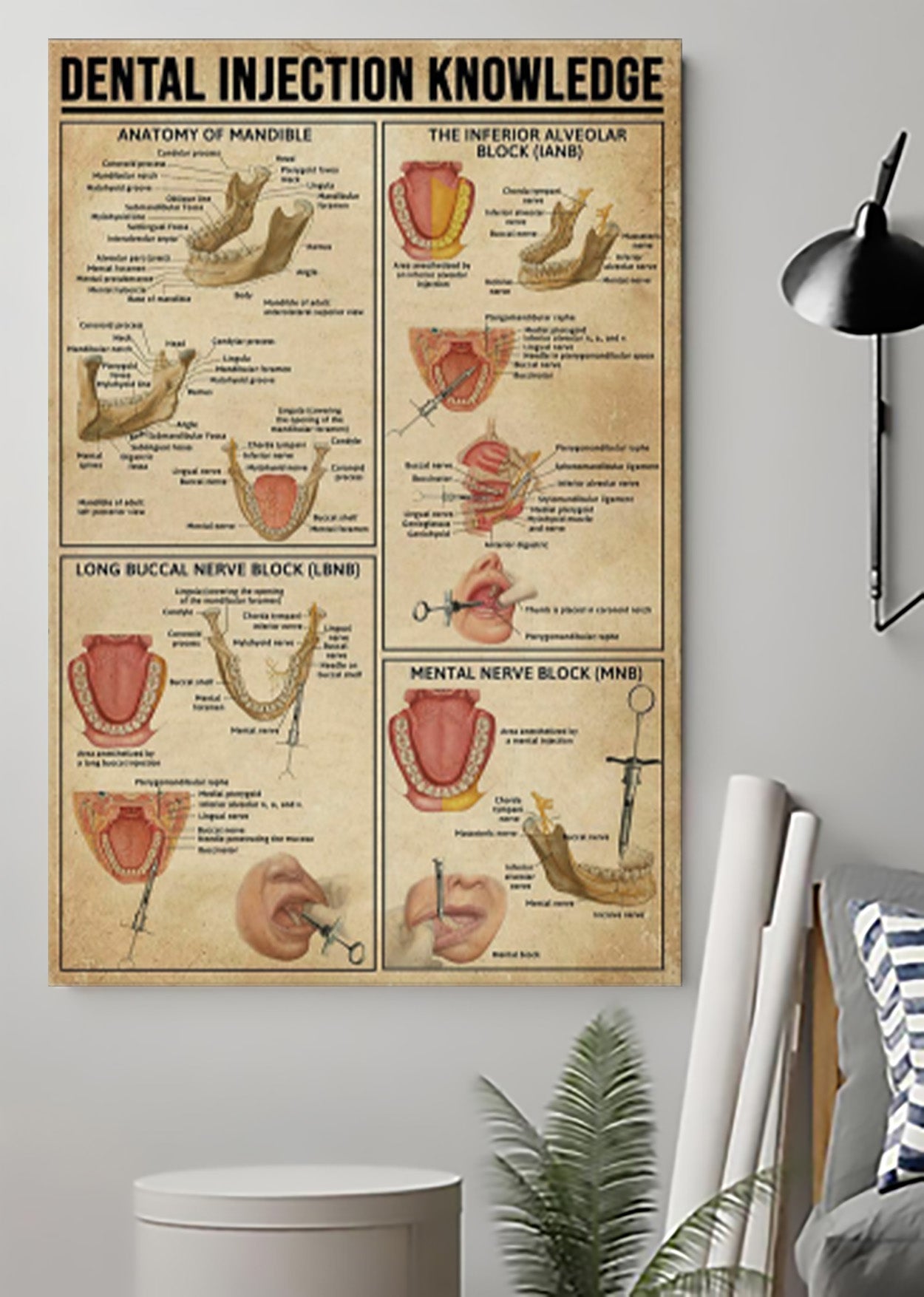 Dental Injection Knowledge Poster