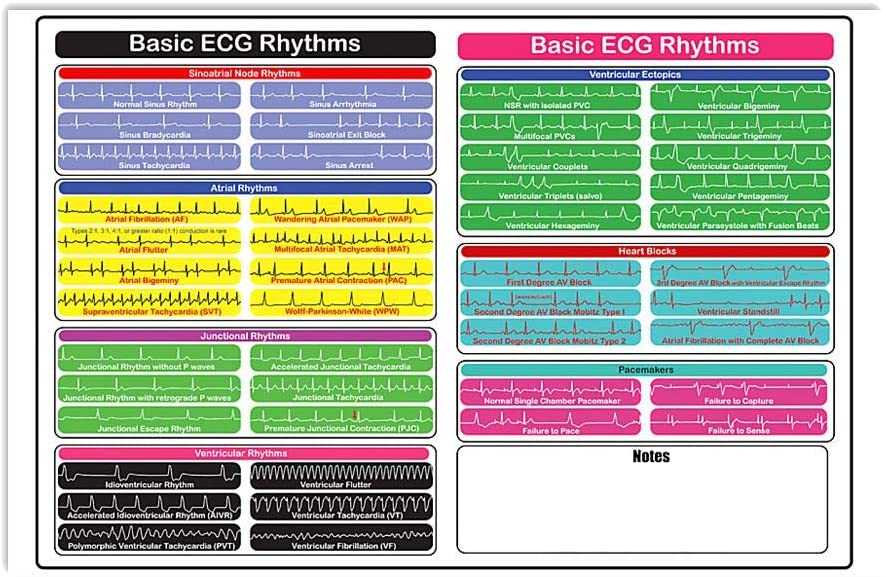 Cardiology Basic Ecg Rhythms Heartbeat Colorful Wall Art Hanging Paper Photography Watercolor Living Bedroom Home Decor No Frame Cardiologist Poster