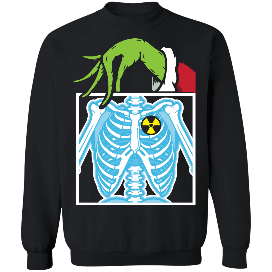 Who Stole Radiology X-ray Ugly Christmas Sweatshirt Adult Unisex