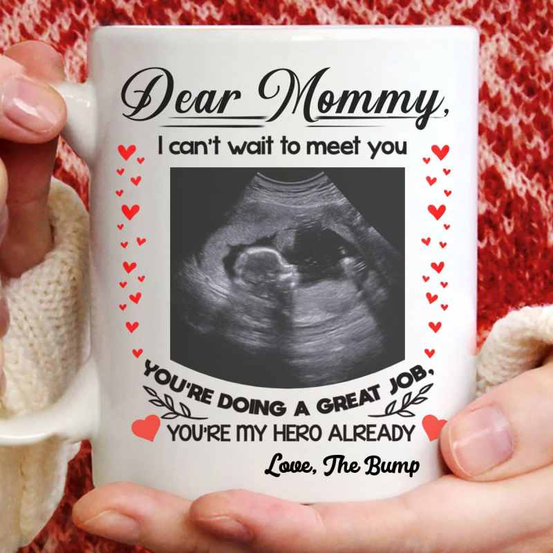 Wonderful Ultrasound Gift For Mommy To Be Mother’S Day Personalized Mug