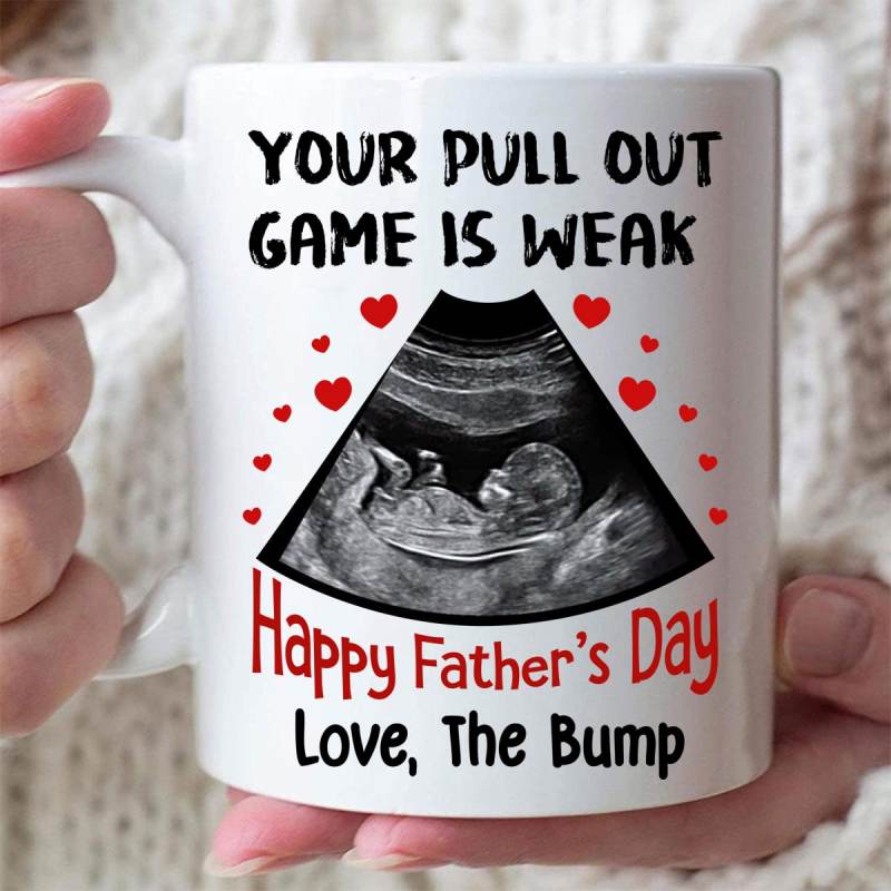 Personalized Ultrasound Pull Out Game Mug Father’S Day Gift For Dad