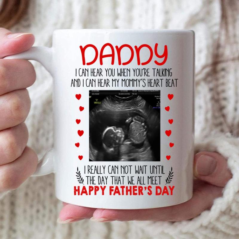 Personalized Sonogram Mug – Happy Father’S Day Gift Mug For Daddy To Be