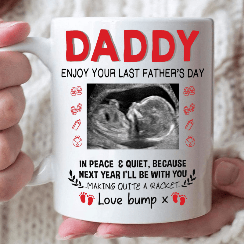 Personalized Father’S Day Gift For Daddy To Be – Custom Sonogram Mug