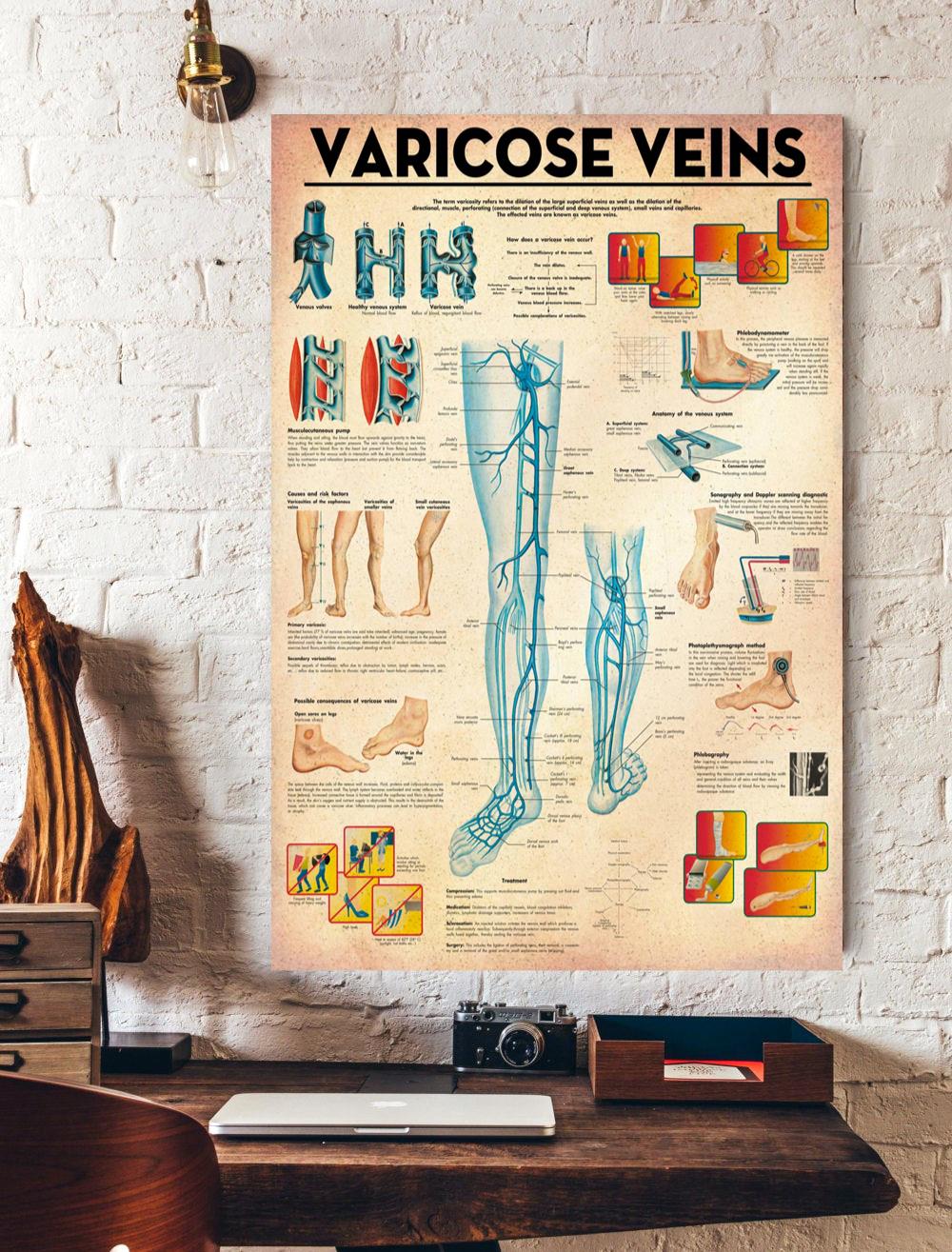 Varicose Viens Knowledge Poster