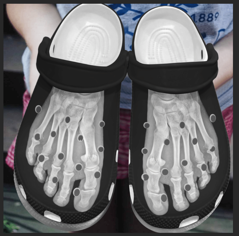 Rad Tech Personalized Clog, Custom Name, Text, Color, Number Fashion Style For Women, Men, Kid, Print 3D X-Ray Foot