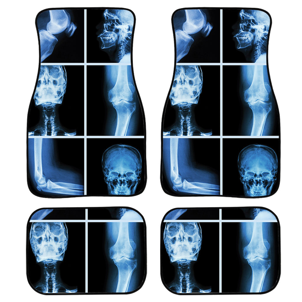 X-Ray Film Radiology Print Front And Back Car Floor Mats, Front Car Mat