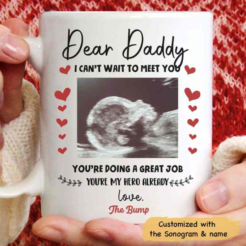 Wonderful Ultrasound Gift For Daddy To Be Father’S Day Personalized Mug