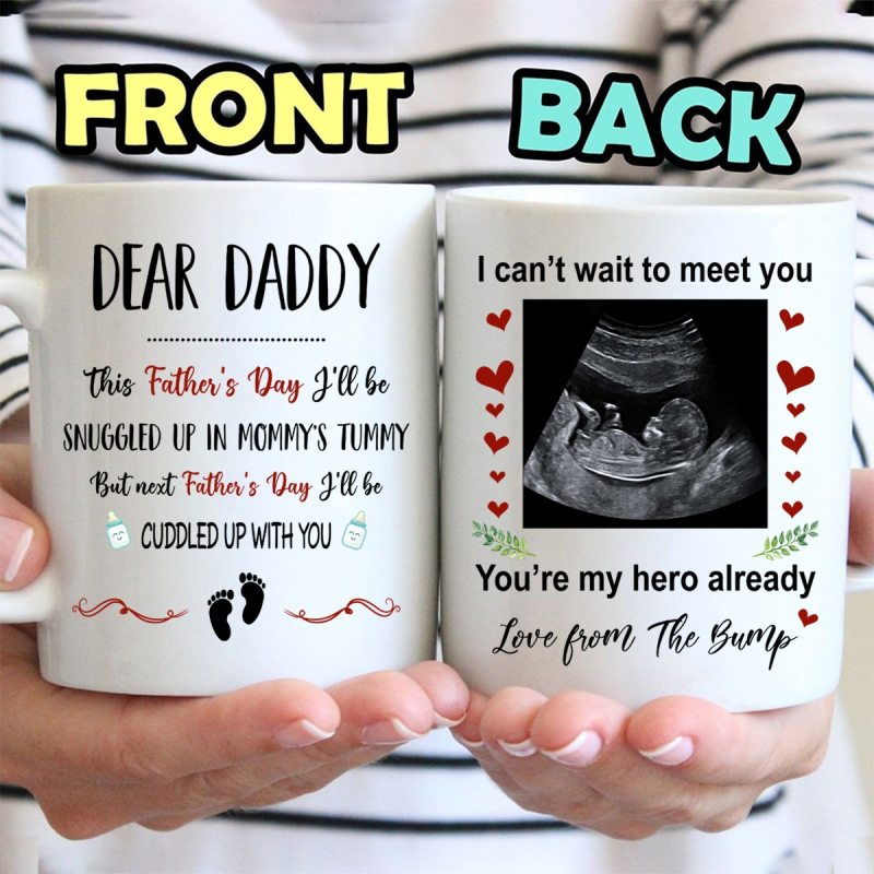 Personalized This Father’S Day Custom Mug, Custom Ultrasound Gift For New Dad