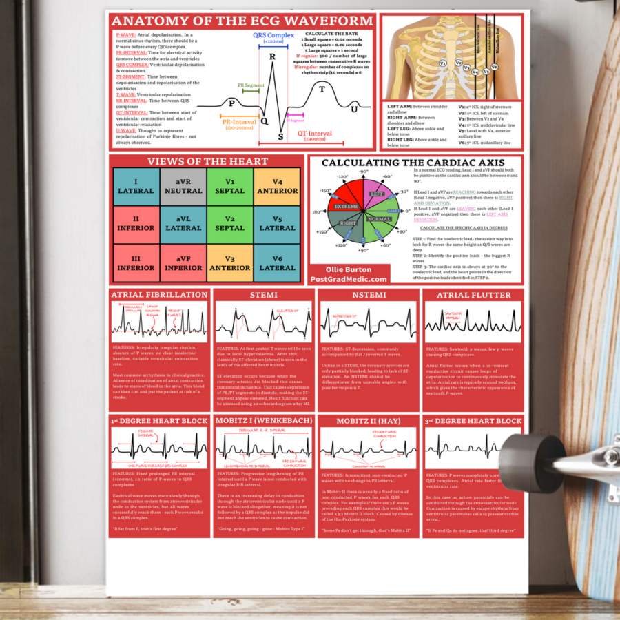 Paramedic Anatomy Of The EGC Waveform Poster Gift For Doctor